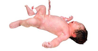 Einem neugeborenen Mädchen, noch bedeckt mit einer weiß-gelben Paste, der Käseschmiere, wird die Nabelschnur hochgehalten, so dass es in der Luft zu schweben scheint.